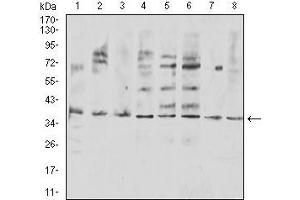 Western Blotting (WB) image for anti-Tumor Necrosis Factor (Ligand) Superfamily, Member 11 (TNFSF11) (AA 74-308) antibody (ABIN5611143)