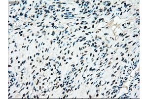 Immunohistochemical staining of paraffin-embedded colon tissue using anti-MAP2K4mouse monoclonal antibody. (MAP2K4 抗体)