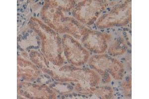 Used in DAB staining on fromalin fixed paraffin- embedded Kidney tissue (GFRA2 抗体  (AA 117-314))