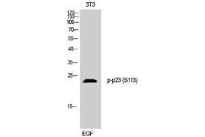 Western Blotting (WB) image for anti-Cyclin-Dependent Kinase 5, Regulatory Subunit 1 (p35) (CDK5R1) (pSer113) antibody (ABIN3179659) (CDK5R1 抗体  (pSer113))