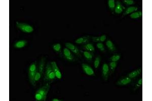 Immunofluorescent analysis of Hela cells using ABIN7153414 at dilution of 1:100 and Alexa Fluor 488-congugated AffiniPure Goat Anti-Rabbit IgG(H+L) (GABPB2 抗体  (AA 163-440))