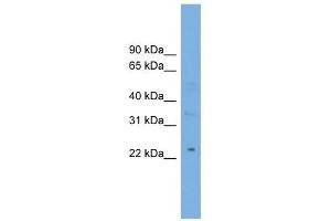 MBL2 antibody used at 1 ug/ml to detect target protein. (MBL2 抗体  (Middle Region))