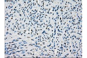 Immunohistochemical staining of paraffin-embedded endometrium tissue using anti-PORmouse monoclonal antibody. (POR 抗体)