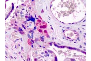Human Placenta: Formalin-Fixed, Paraffin-Embedded (FFPE) (GATA3 抗体  (N-Term))