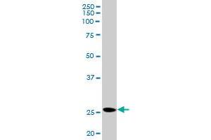 PRL MaxPab rabbit polyclonal antibody. (Prolactin 抗体  (AA 1-227))