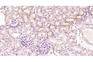 Paraformaldehyde-fixed, paraffin embedded Rat kidney, Antigen retrieval by boiling in sodium citrate buffer (pH6. (Kininogen-1 Light Chain 抗体)