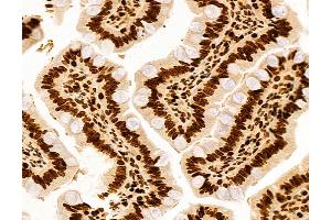 ABIN6260553 and ABIN6272990 at 1/100 staining Rat colon tissue by IHC-P. (CCDC115 抗体  (Internal Region))
