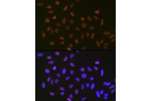 Immunofluorescence (IF) image for anti-Small Ubiquitin Related Modifier 2 (SUMO2) antibody (ABIN7270370)