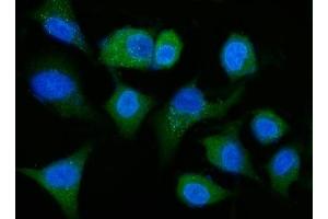IF analysis of ALDH1A1 using anti-ALDH1A1 antibody (ABIN7602128).