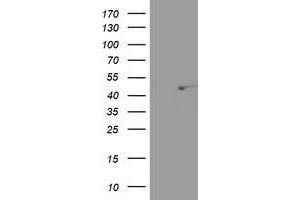 Western Blotting (WB) image for anti-SEC14-Like 2 (SEC14L2) antibody (ABIN1500854) (SEC14L2 抗体)