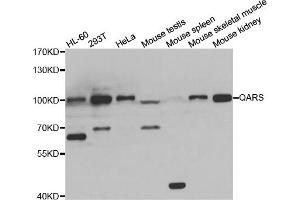 Western blot analysis of extracts of various cell lines, using QARS antibody (ABIN5974184) at 1/1000 dilution. (QARS 抗体)