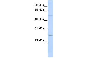WB Suggested Anti-FTHL17 Antibody Titration:  0.