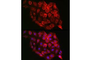Immunofluorescence analysis of C6 cells using PSMD8 Rabbit pAb (ABIN6129443, ABIN6146347, ABIN6146348 and ABIN6222706) at dilution of 1:100 (40x lens).