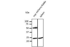 Anti-Rab8 Ab at 1/500 dilution, Iysates at 50 per Iane, rabbit polyclonal to Goat IgG (HRP) at 1/10,000 dilution,