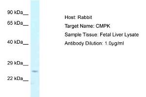 Host: Rabbit Target Name: CMPK Sample Tissue: Human Fetal Liver Antibody Dilution: 1ug/ml (Cytidine Monophosphate (UMP-CMP) Kinase 1, Cytosolic (CMPK1) (N-Term) 抗体)
