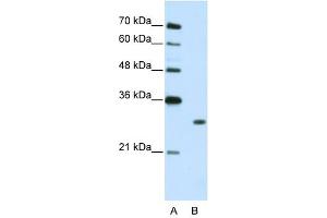 MBNL1 antibody used at 2. (MBNL1 抗体)