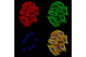 DPP9 - Catalytic domain Antibody staining Hela cells by IF/ICC.