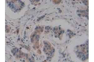 Immunohistochemistry (IHC) image for anti-Carboxypeptidase B2 (Plasma) (CPB2) (AA 138-386) antibody (ABIN7432202)