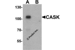 Western Blotting (WB) image for anti-Calcium/calmodulin-Dependent serine Protein Kinase (MAGUK Family) (CASK) (N-Term) antibody (ABIN1031293) (CASK 抗体  (N-Term))