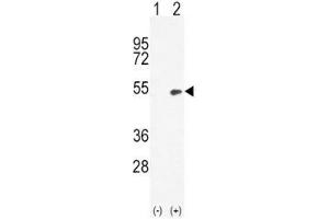 Western blot analysis of BMP4 antibody and 293 cell lysate (2 ug/lane) either nontransfected (Lane 1) or transiently transfected (2) with the BMP4 gene. (BMP4 抗体  (AA 5-34))