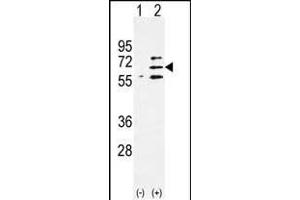 Western blot analysis of Parp6 (arrow) using rabbit polyclonal Parp6 Antibody (C-term) (ABIN390248 and ABIN2840713). (PARP6 抗体  (C-Term))