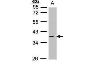 WB Image Sample (30μg whole cell lysate) A:Raji , 10% SDS PAGE antibody diluted at 1:1000 (MCL-1 抗体  (Center))
