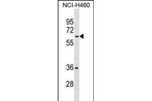 MDH1B Antibody (Center) (ABIN1538277 and ABIN2849269) western blot analysis in NCI- cell line lysates (35 μg/lane). (MDH1B 抗体  (AA 304-332))