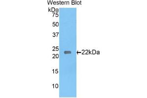 Western blot analysis of the recombinant protein. (Laminin gamma 1 抗体  (AA 1228-1404))