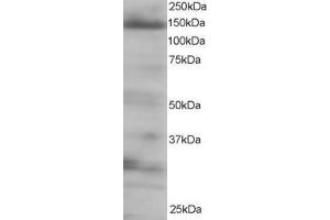 Western Blotting (WB) image for anti-Eukaryotic Translation Initiation Factor 4E Nuclear Import Factor 1 (EIF4ENIF1) (C-Term) antibody (ABIN185154)