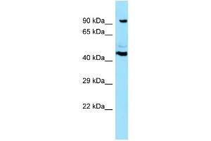 WB Suggested Anti-SPECC1 Antibody Titration: 1. (NSP5 抗体  (N-Term))