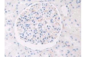 Used in DAB staining on fromalin fixed paraffin- embedded kidney tissue (HPR 抗体  (AA 30-85))