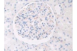 Used in DAB staining on fromalin fixed paraffin- embedded kidney tissue (HPR 抗体  (AA 30-85))
