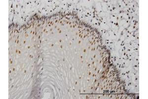 Image no. 3 for anti-Metastasis Associated 1 (MTA1) (AA 601-701) antibody (ABIN598597) (MTA1 抗体  (AA 601-701))