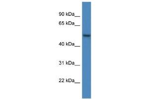 WB Suggested Anti-ARHGAP19 AntibodyTitration: 1. (ARHGAP19 抗体  (C-Term))
