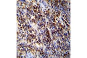 Immunohistochemistry (Paraffin-embedded Sections) (IHC (p)) image for anti-Poly (ADP-Ribose) Polymerase Family, Member 9 (PARP9) (AA 569-601), (C-Term) antibody (ABIN953999)