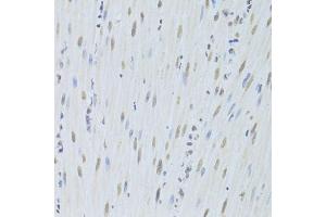 Immunohistochemistry of paraffin-embedded mouse esophagus using HNRNPK Antibody.