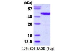 Image no. 1 for L-Lactate Dehydrogenase (LLDD) (AA 1-396) protein (His tag) (ABIN6386968) (L-Lactate Dehydrogenase (LLDD) (AA 1-396) protein (His tag))