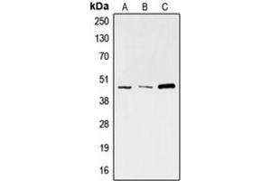 Western blot analysis of SKP2 expression in A673 (A), HeLa (B), K562 (C) whole cell lysates. (SKP2 抗体  (C-Term))