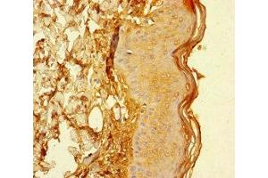 Immunohistochemistry of paraffin-embedded human skin tissue using ABIN7147268 at dilution of 1:100 (CYREN (AA 1-157) 抗体)