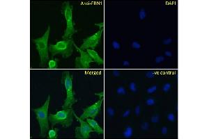 ABIN570798 Immunofluorescence analysis of paraformaldehyde fixed U251 cells, permeabilized with 0. (Fibrillin 1 抗体  (Internal Region))
