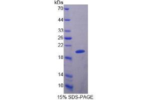 SDS-PAGE (SDS) image for Slit Homolog 2 (Drosophila) (SLIT2) (AA 209-374) protein (His tag) (ABIN1171386)