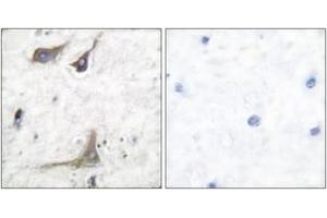 Immunohistochemistry analysis of paraffin-embedded human brain tissue, using Cox1 Antibody. (COX1 抗体  (AA 550-599))