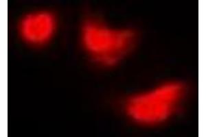 Immunofluorescence (IF) image for anti-IMP (Inosine 5'-Monophosphate) Dehydrogenase 2 (IMPDH2) antibody (ABIN7306258)