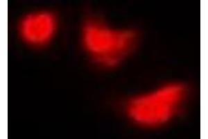 Immunofluorescent analysis of IMPDH2 staining in Hela cells.
