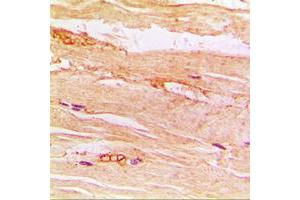 Immunohistochemical analysis of GLUT4 staining in human muscle formalin fixed paraffin embedded tissue section. (GLUT4 抗体  (Center))