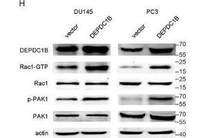 DEPDC1B regulates the Rho signaling pathway and binds to Rac1. (PAK1 抗体  (AA 1-240))