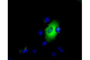 Image no. 10 for anti-Lipase, Endothelial (LIPG) antibody (ABIN1499163) (LIPG 抗体)