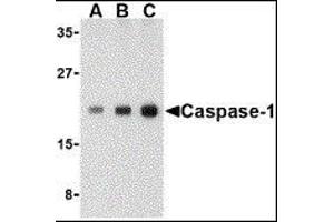 Western Blotting (WB) image for anti-Caspase 1 (CASP1) (C-Term) antibody (ABIN2477902) (Caspase 1 抗体  (C-Term))