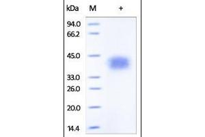 Human TNFR2, His Tag on SDS-PAGE under reducing (R) condition.