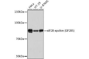 Western blot analysis of extracts of various cell lines, using eIF2B epsilon (EIF2B5) (EIF2B5) Rabbit mAb (ABIN7267038) at 1:1000 dilution. (EIF2B5 抗体)